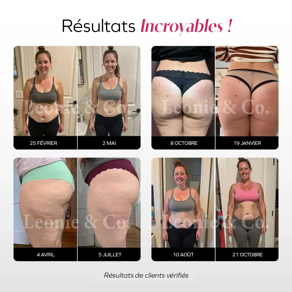 Legging Drenante 3D Anticelulitis Compresivo